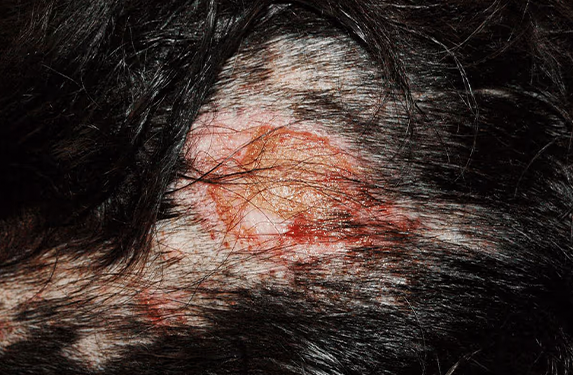 Hot spot on the back of a dog